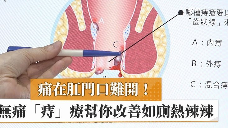 白条取现容易通过吗