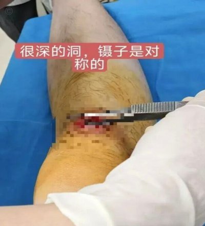 绑卡领现金的app